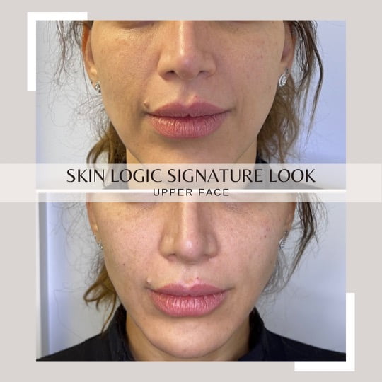 Skin Logic Signature Look | Skinlogicottawa | Ottawa
