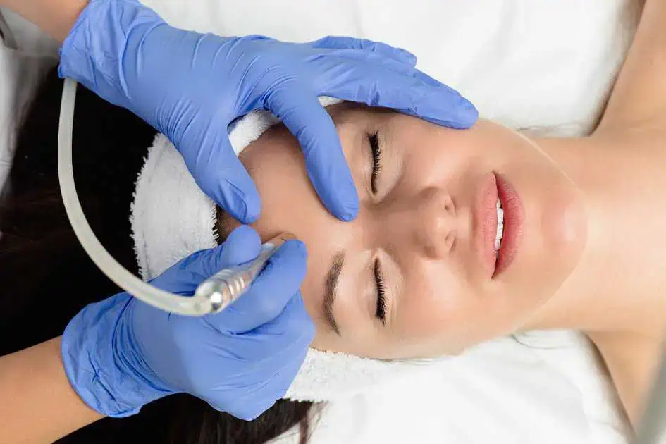 Microneedling in Ottawa, ON by Skin Logic Ottawa INC